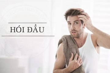 Hói đầu có chữa được không