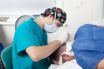 Chi phí cấy tóc
