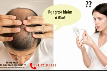 Khám rụng tóc ở đâu