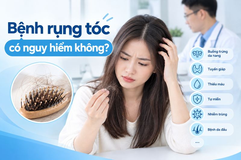 bệnh rụng tóc có nguy hiểm không