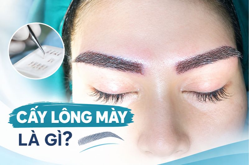 cấy lông mày là gì
