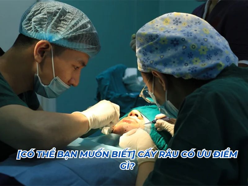 cấy râu có ưu điểm gì