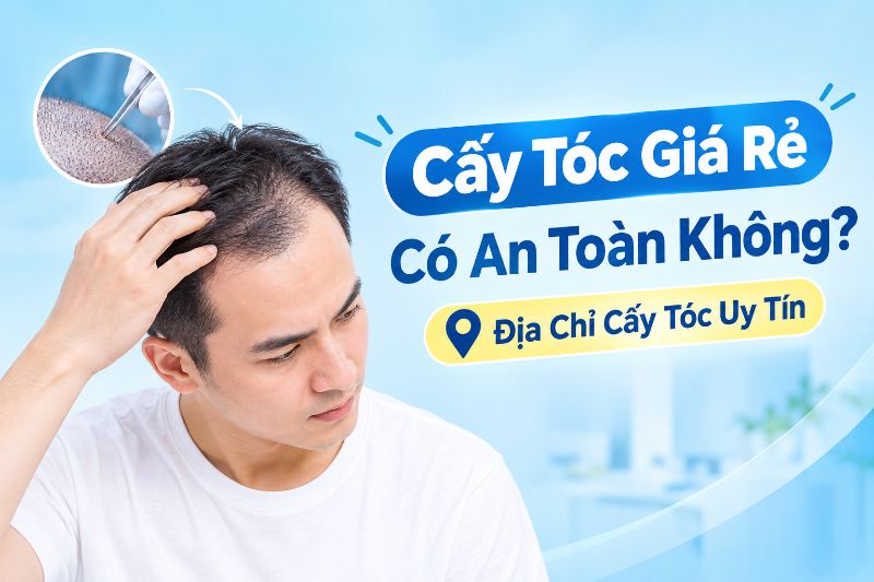 cấy tóc giá rẻ có an toàn không