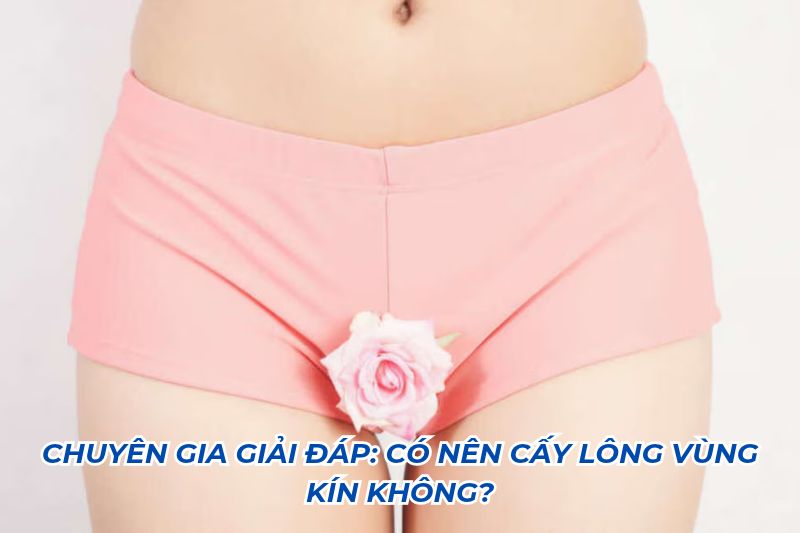 có nên cấy lông vùng kín không