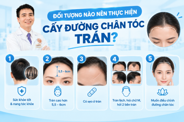 đối tượng nên thực hiện hạ trán cao