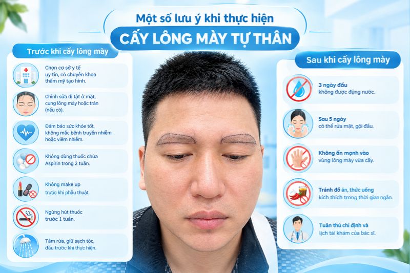 lưu ý khi cấy lông mày tự thân