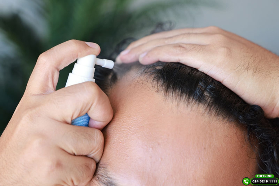 minoxidil