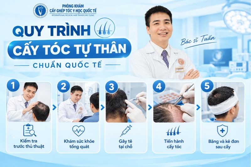 quy trình cấy tóc tự thân 