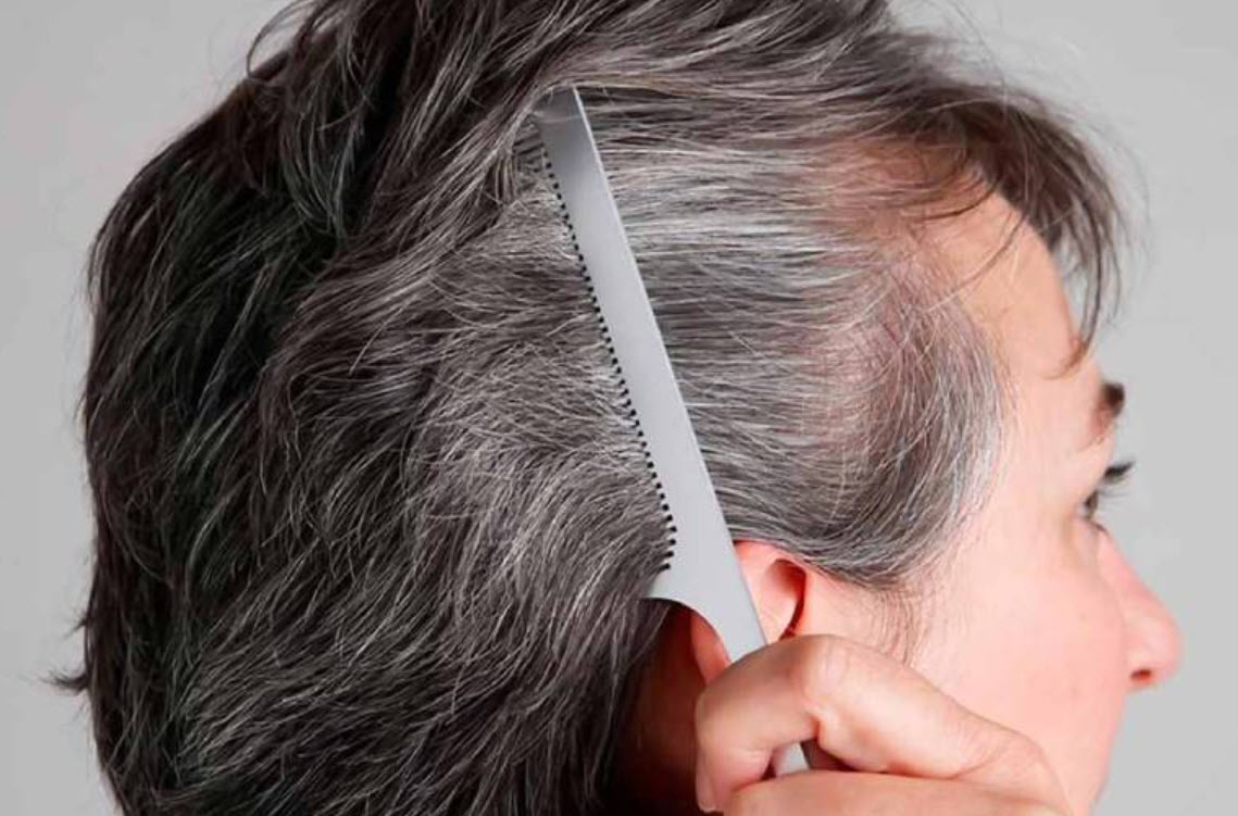 rụng tóc do quá trình lão hoá 