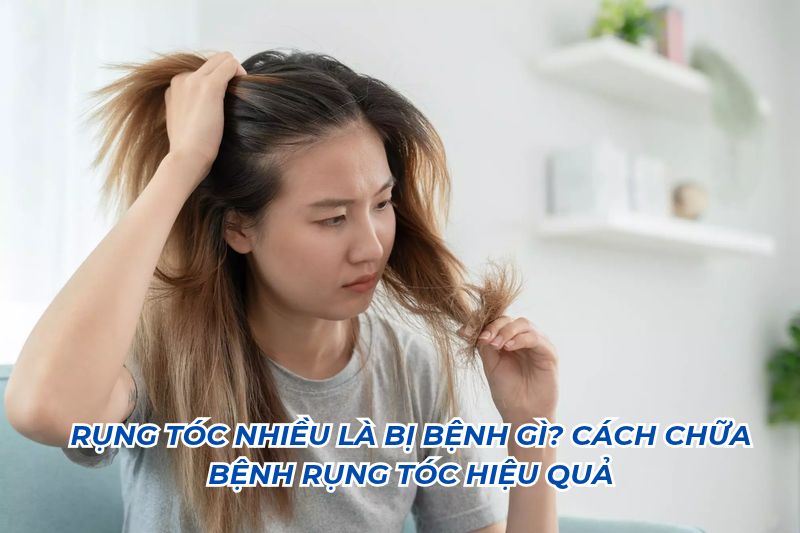 rụng tóc nhiều là bệnh gì