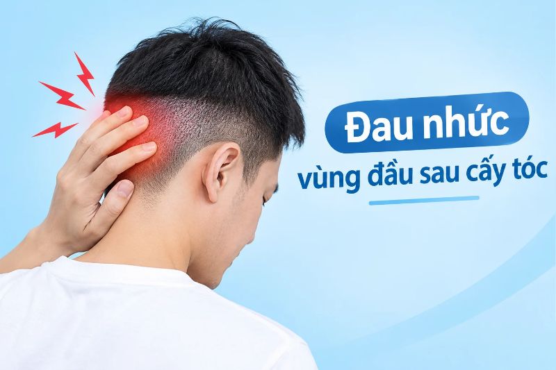 đau nhức vùng đầu sau cấy