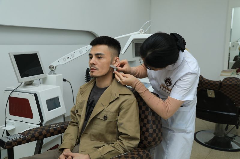 xác định khu vực để râu 
